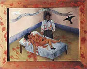 A Few Small Nips 1935 By Frida Kahlo