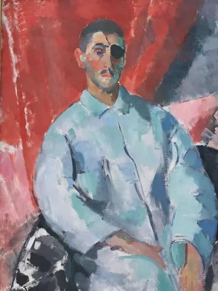 Self Portrait with Black Eye Patch | Oil Painting Reproduction